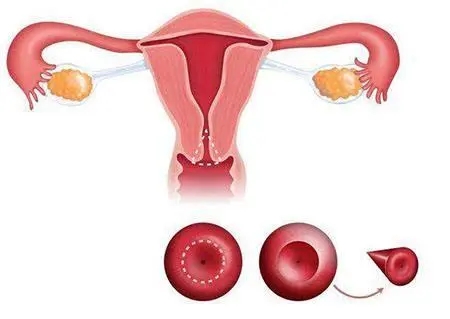 贝安健康：宫颈性不孕的早期症状